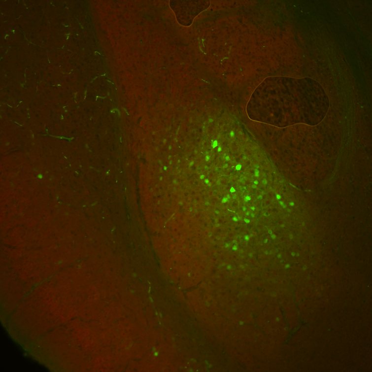 basolateral amygdala neurons 2