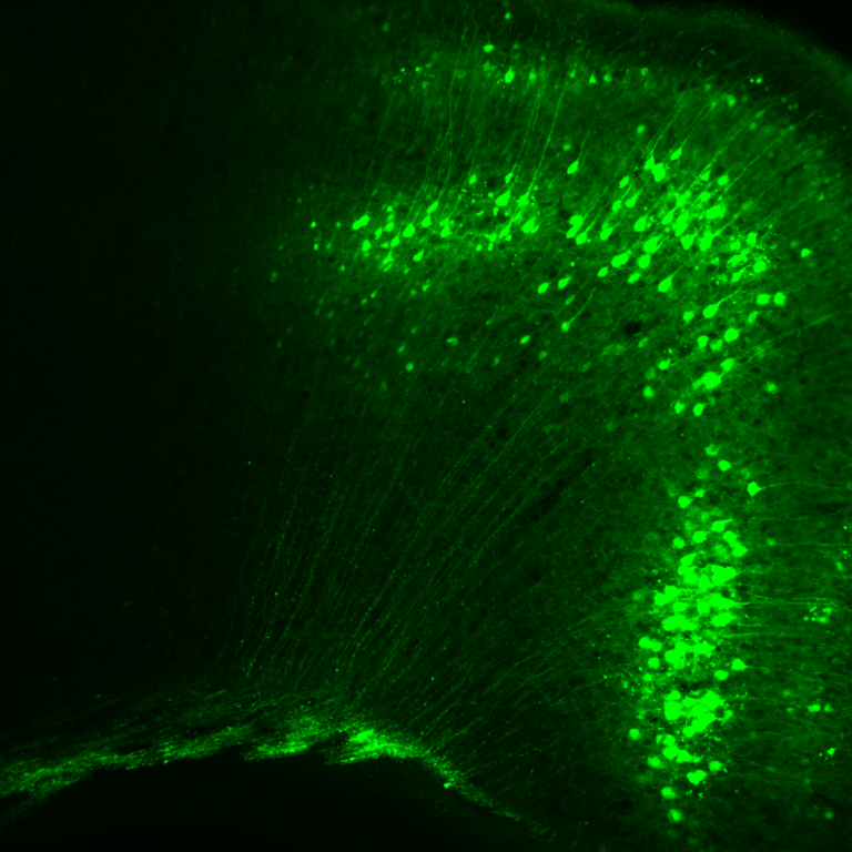 cortical neurons